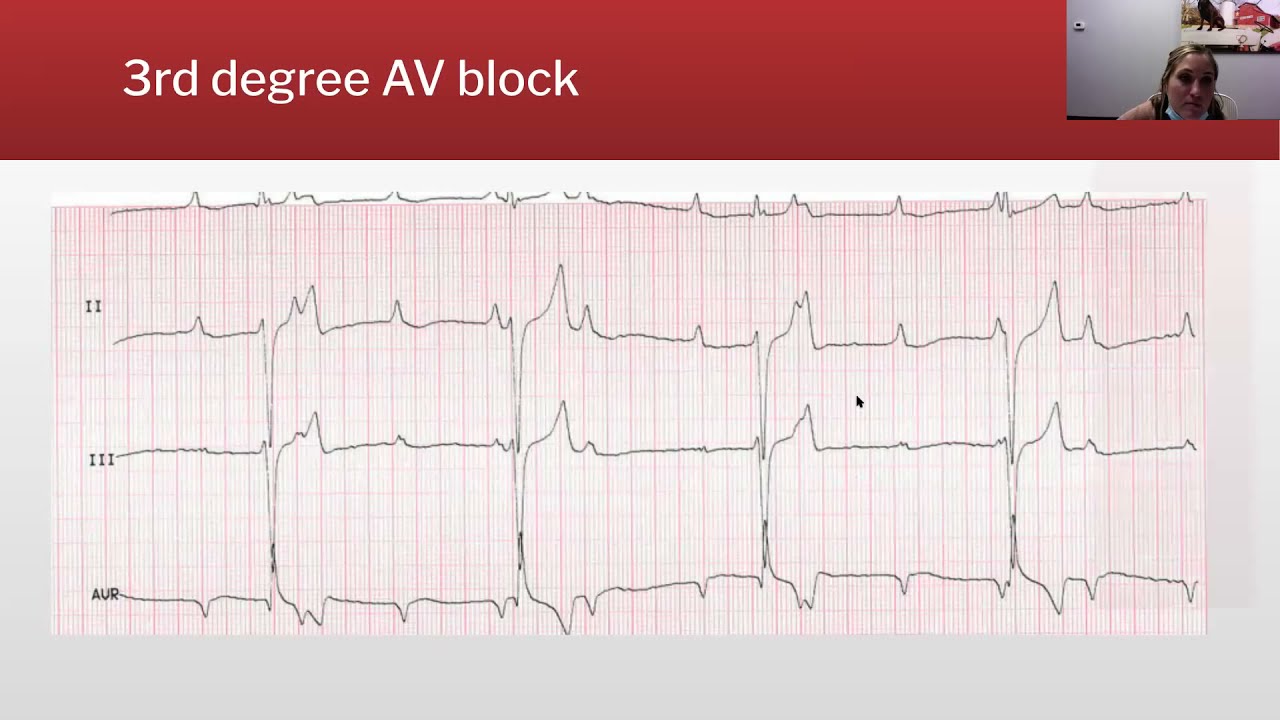 Dr  Rodrigez ECG Rounds, session 2