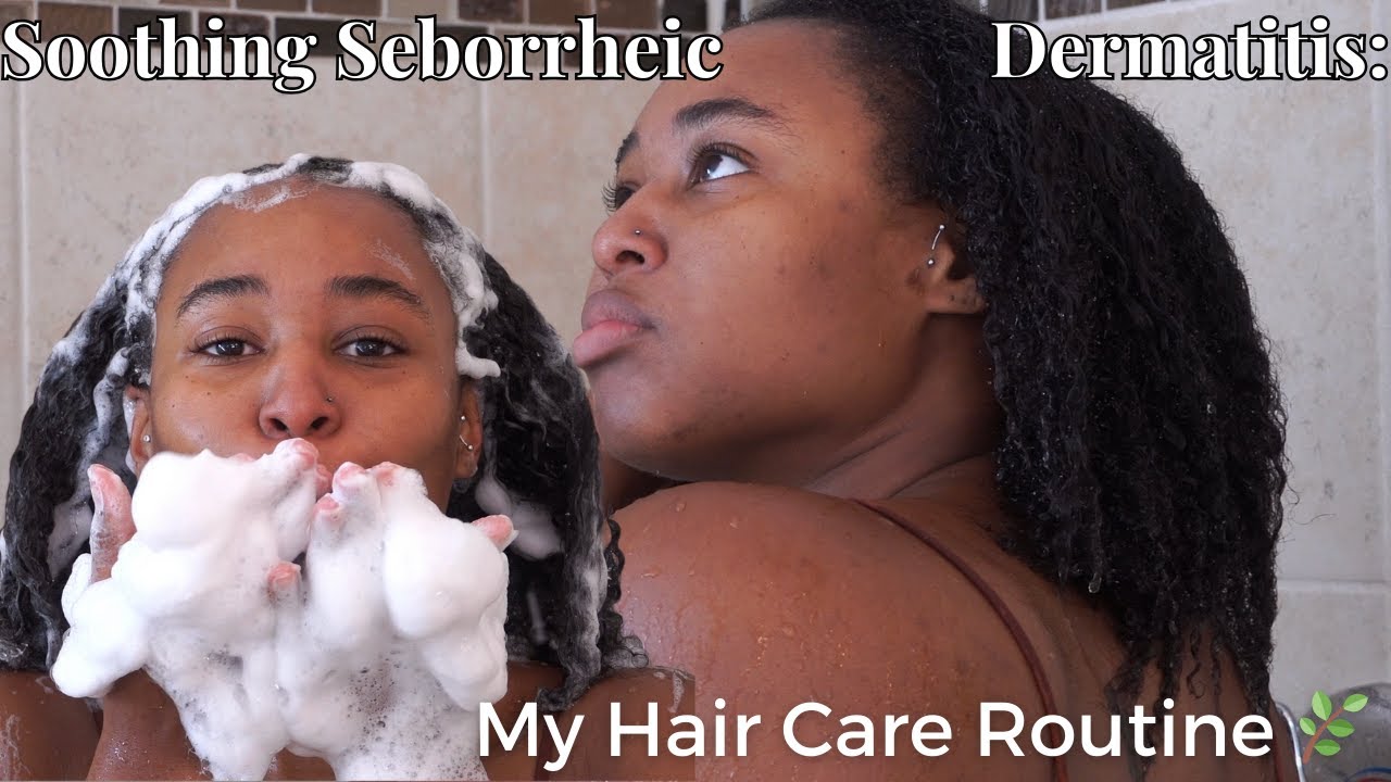 VLOTOGER DAY 3 Banish Seborrheic Dermatitis My Healing Hair Care