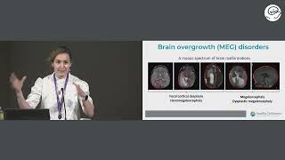 Epilepsy Symposium 2022