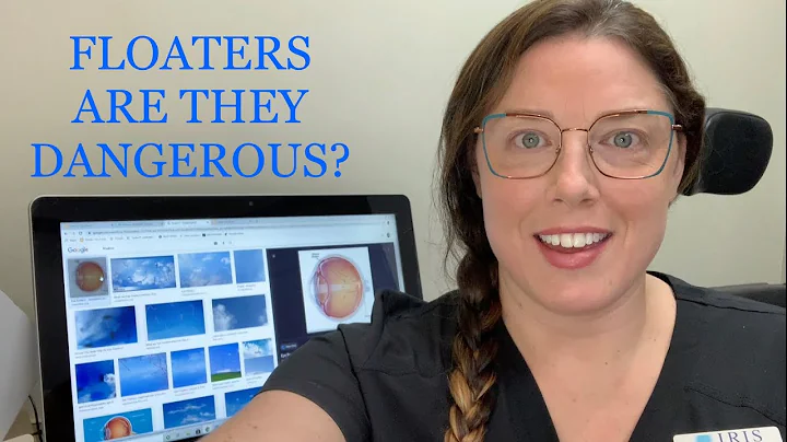 What are Floaters? Are they Dangerous?