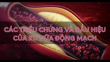 Các triệu chứng dấu hiệu của xơ vữa động mạch | Alo bác sĩ Chuyên trang Tạp chí Sức khoẻ Cộng đồng
