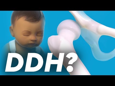 Video: Asymmetrical Folds On The Legs Of The Child: Norm Or Deviation