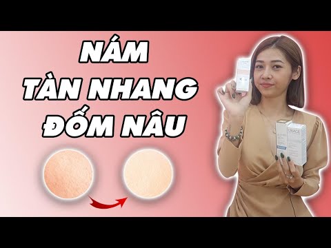 Tập 1 | CÁCH TRỊ NÁM, TÀN NHANG, THÂM SẠM AN TOÀN - HIỆU QUẢ