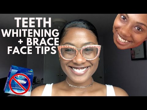 How to get white teeth + Braces tips | No whitening strips