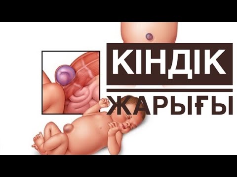 Video: Киндик сызыгы керекпи?