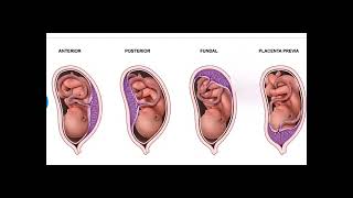 Anterior Placenta means baby Girl or Boy |Posterior Placenta means baby Girl or Boy |PlacentaPrevia