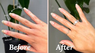 Nail Care Maintenance Routine | SELFCARE