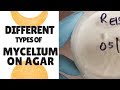 A Look At Some Different Types of Mycelium on Agar