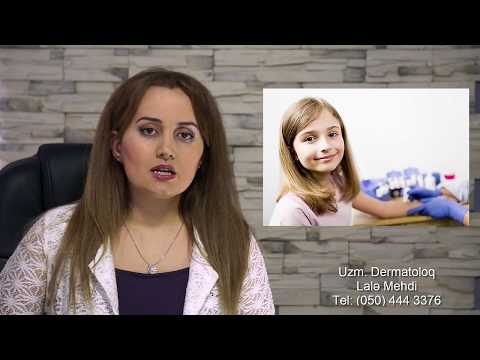 Video: Uşaqlarda Atopik Dermatitin Psixoterapiyası
