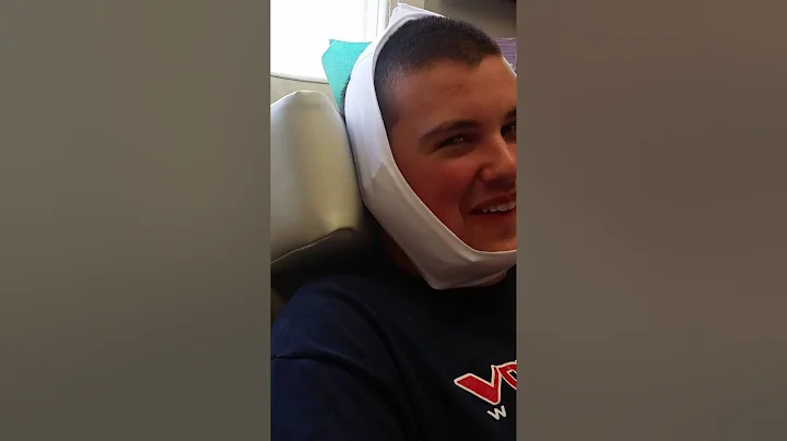 Austin Adcock after wisdom teeth extraction