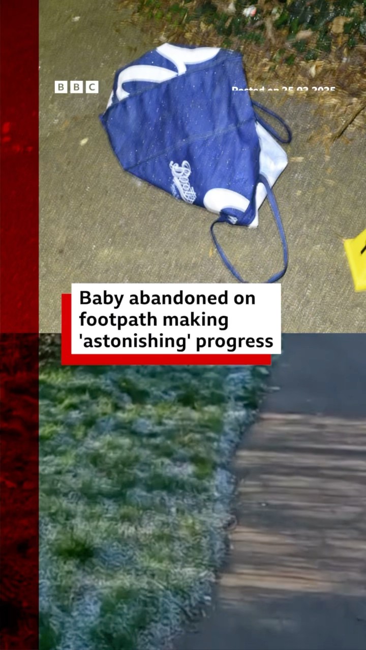Baby abandoned on London footpath making 'astonishing' progress. #London #BBCNews