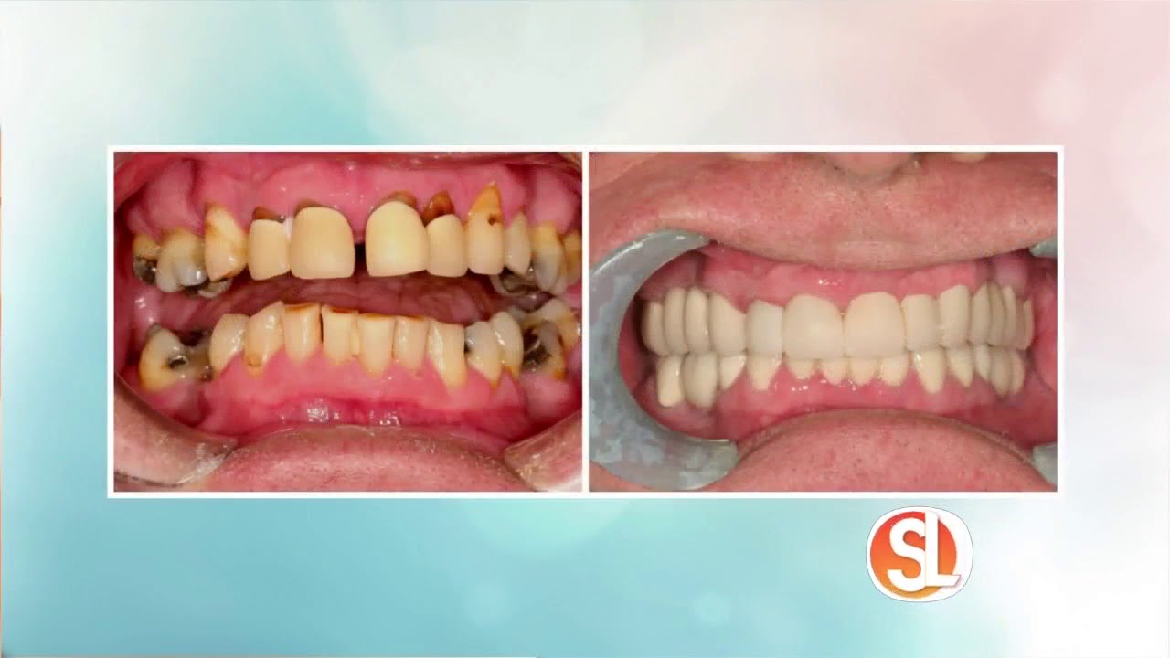 Dental Design of Arcadia talks about reconstructive dentistry
