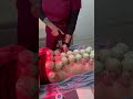 Chiropractic Adjustment  Acupuncture   Cupping Therapy! Part 2