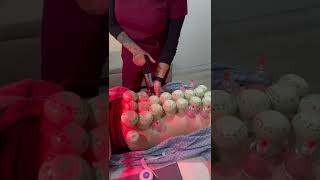 Chiropractic Adjustment +Acupuncture + Cupping Therapy! Part 2 screenshot 4