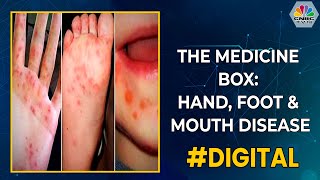 The Medicine Box: Hand, Foot & Mouth Disease | CNBC-TV18