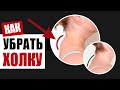 Как избавиться от холки