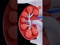 From Dialysis to Transplants: Doctor’s Mission to Make Kidney Care Affordable