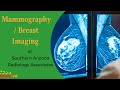 Mammographybreast imaging at southern arizona radiology associates