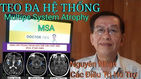 Bệnh teo tiểu não di truyền như thế nào năm 2024