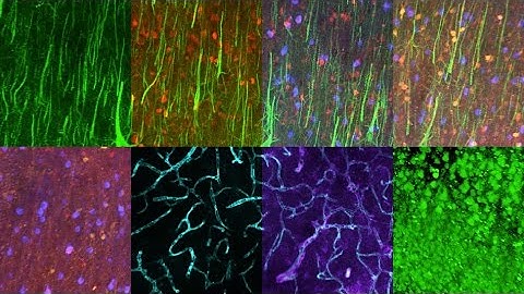 Imaging brain proteins