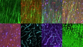 Imaging brain proteins