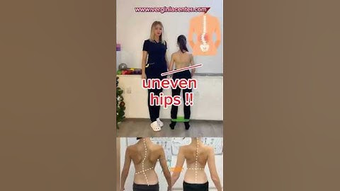 Uneven Hips or Scoliosis? Do This Exercise Now!  www.verginiacenter.com