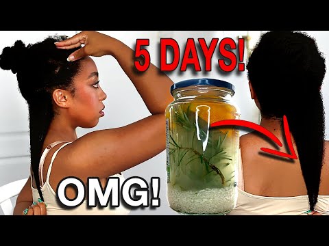 THE MOST POWERFUL RICE WATER FOR EXTREME HAIR GROWTH! | HOW TO MAKE RICE WATER FOR SUPER HAIR GROWTH
