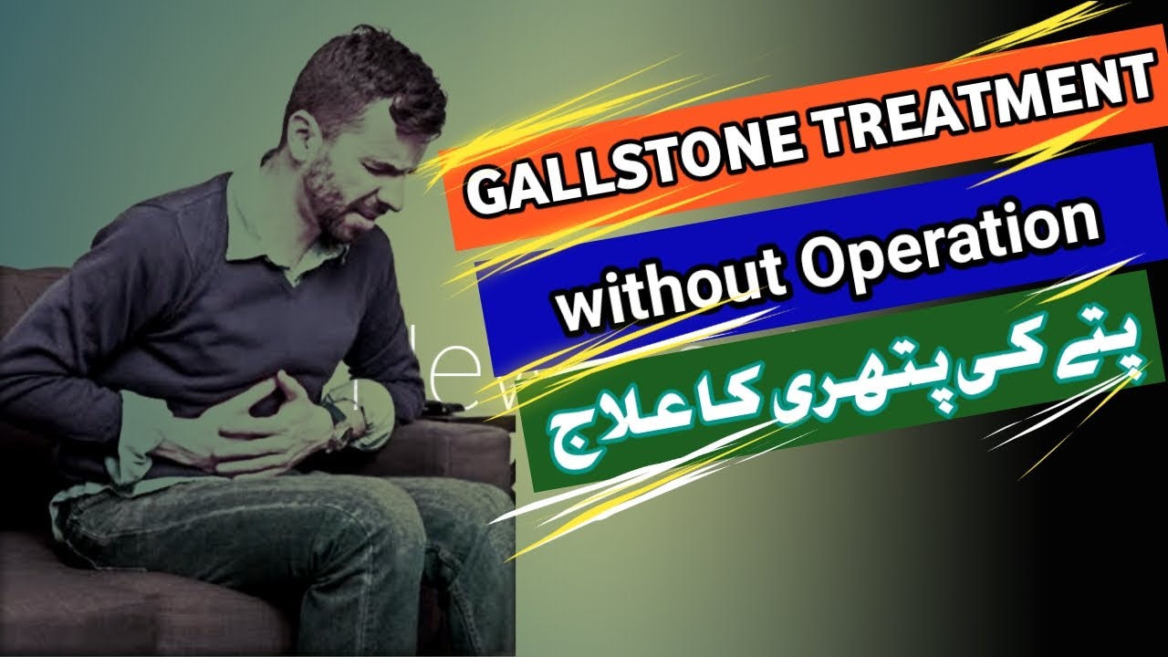How to treat and prevent gallstone/Urdu/Hindi YouTube