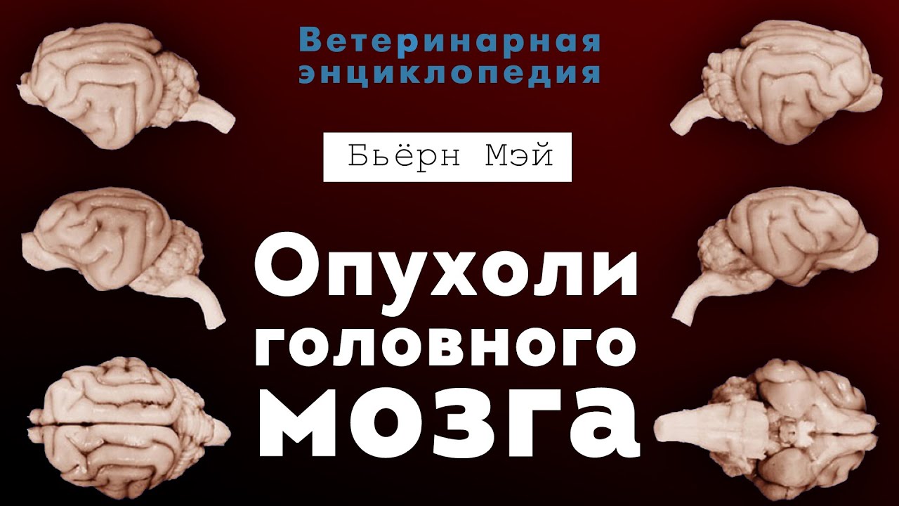 Опухоли головного мозга