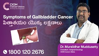 Play video: Symptoms of Gallbladder Cancer