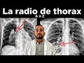 Radiographie de thorax de a  z  les bases dinterprtation