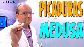 ¿Por qué no se debe frotar una picadura de medusa?