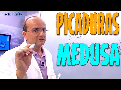 Vídeo: Picadura De Medusa: Síntomas, Tratamientos Y Más