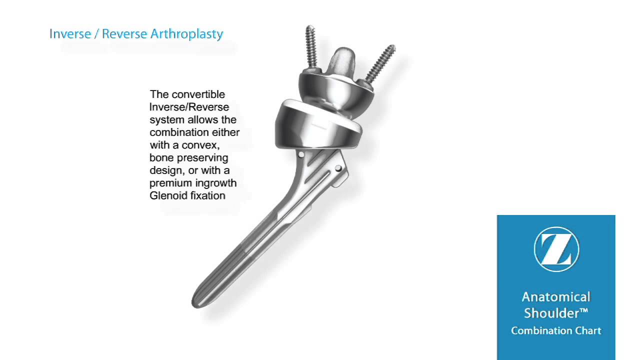 Anatomical Shoulder Inverse/Reverse System YouTube
