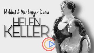 Helen Keller : Cerita Kehidupan Sedih dan Inspirasi Terbaik