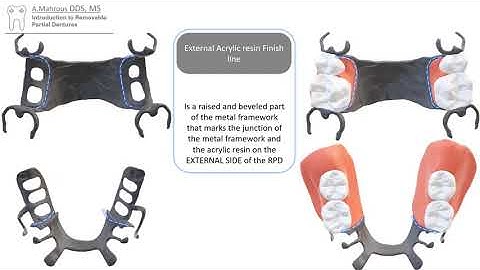 RPD introduction in 5 mins