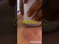 VENTOSA