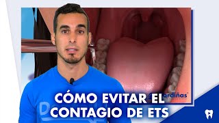 Cómo PREVENIR las enfermedades de transmisión sexual (ETS) | #Shorts