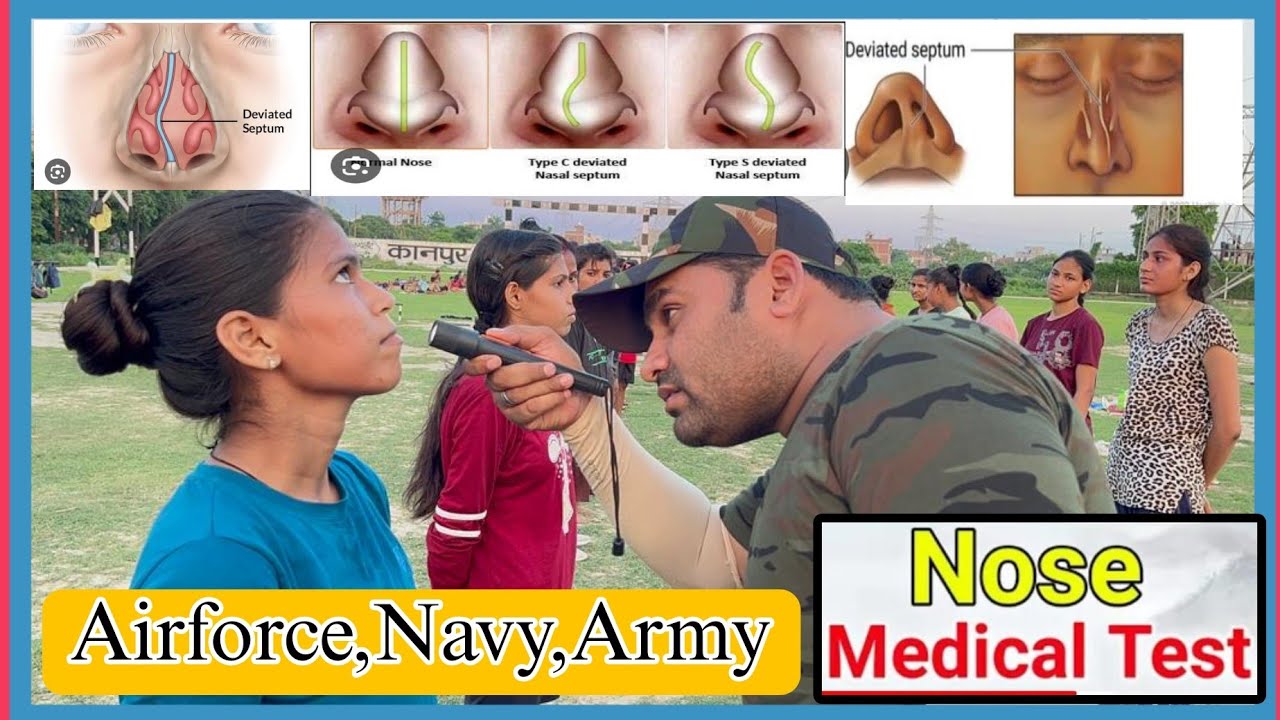 Nose test in indian army ||आर्मी में नाक ऐसे चैक होती है | Dns problem solve Test Full Video!!!
