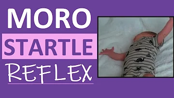 Is startle reflex normal in adults?