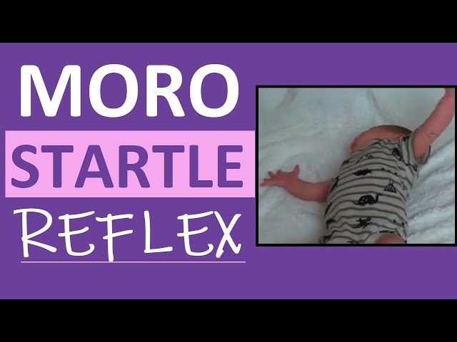 Moro Reflex Newborn Test | Startle Reflex | Pediatric Nursing Assessment class=