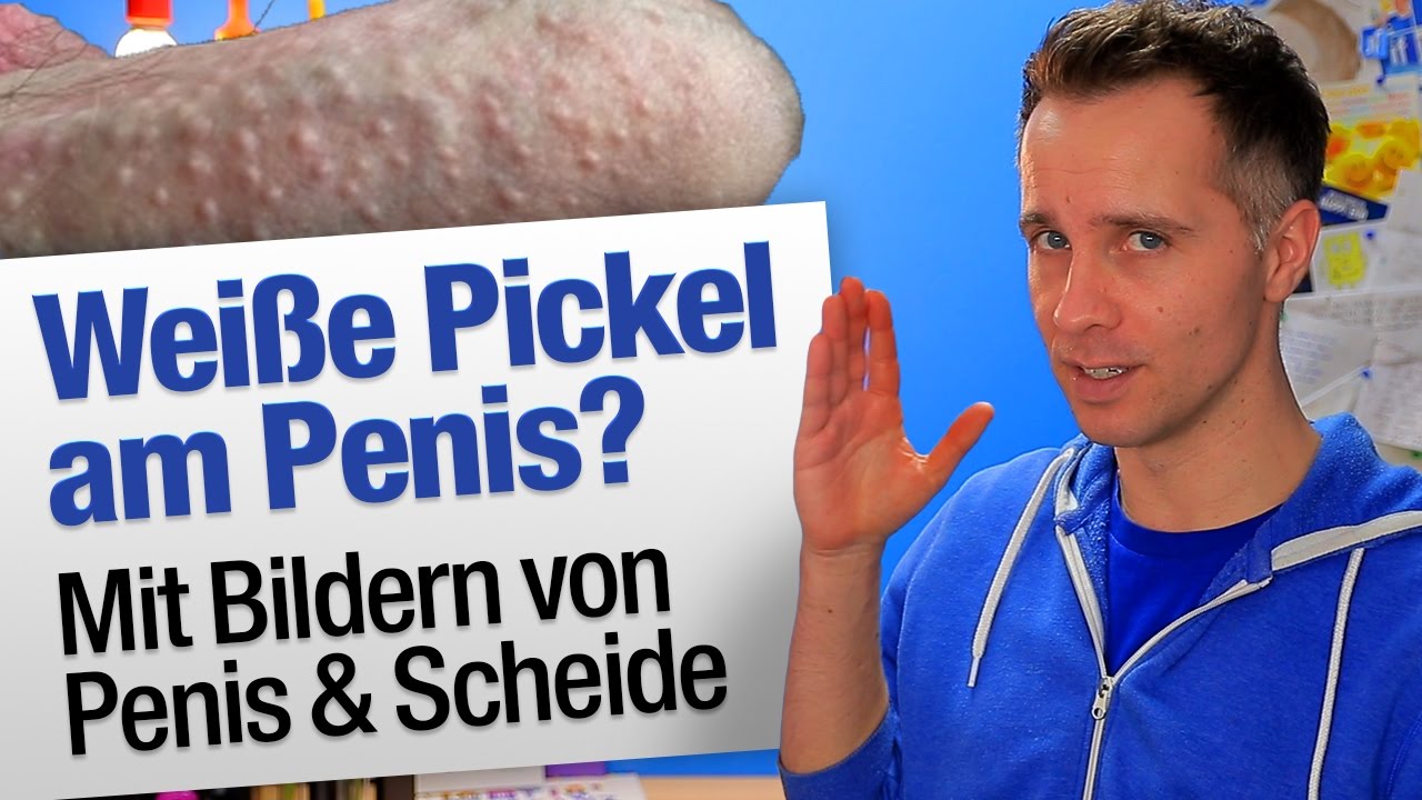 Pickel am penisschaft