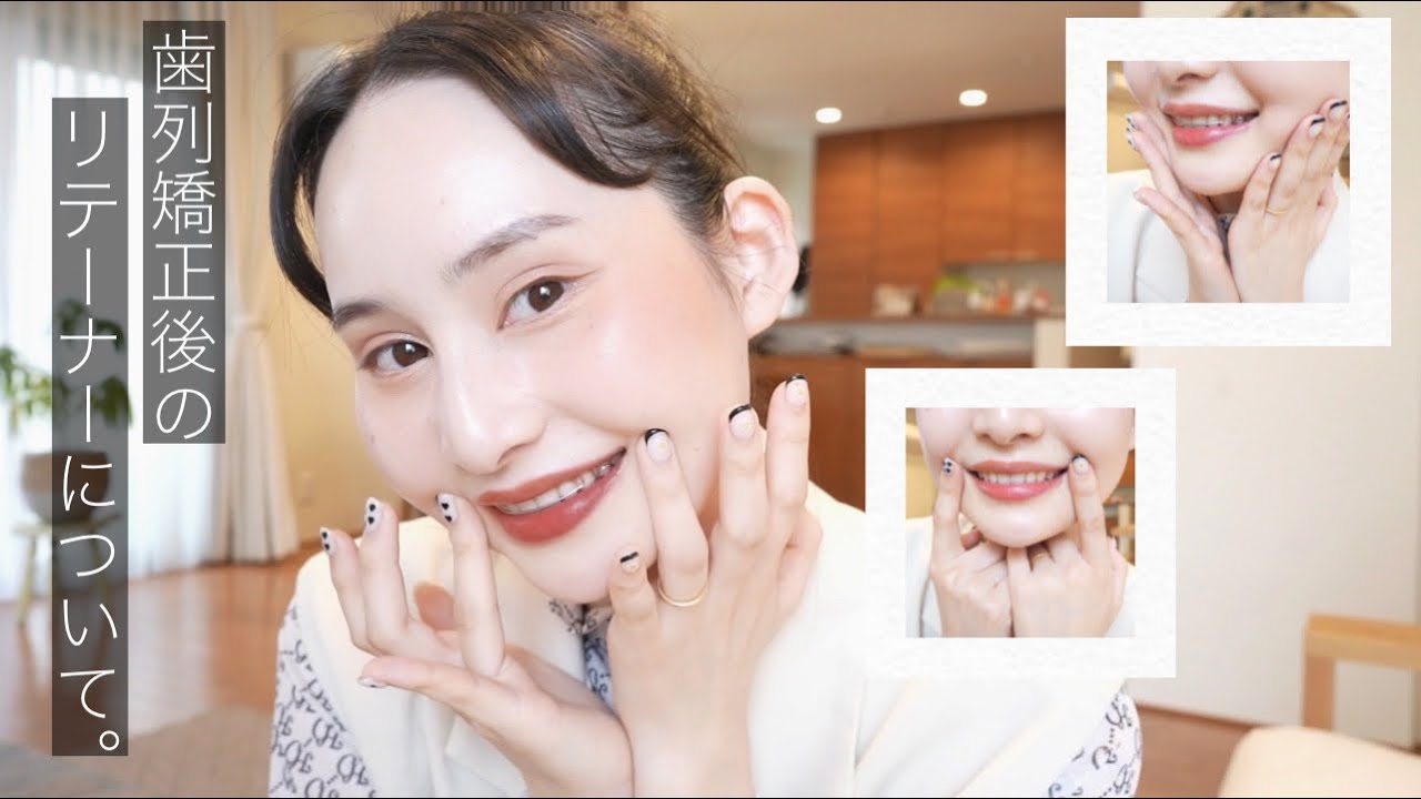 【歯列矯正】歯列矯正後のリテーナーについて詳しく解説したよ♡