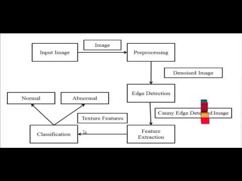 Final Year Projects 2015 | Breast Cancer Histopathology Image Analysis: A Review