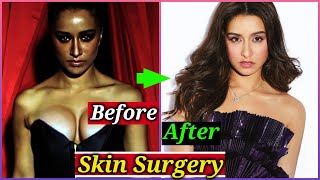 Bollywood Actresses who Went For Skin Lightening Treatment | Shraddha Kapoor, Priyanka Chopra, Alia screenshot 4