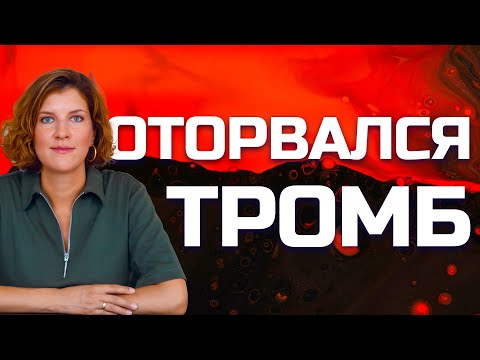 Тромб оторвался - тромбоэмболия легочной артерии