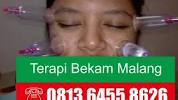 Video untuk bekam panggilan Malang