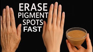 प्राकृतिक रूप से पिगमेंट स्पॉट और हाथ की झुर्रियाँ मिटाएँ | DIY एंटी-एजिंग हैंड रेमेडी screenshot 2