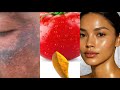 Tomato and tumeric clears all dark spots and wrinkles