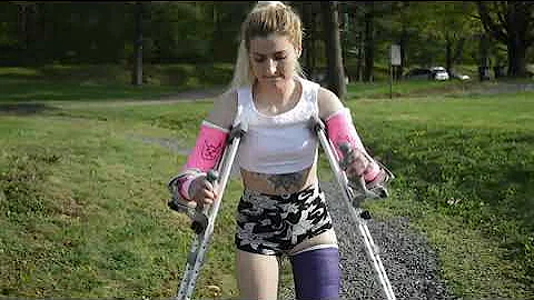 Woman Walking Crutches With Two Broken Legs And Arms 